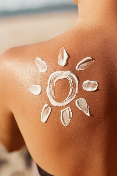 Zonnebrand met SPF